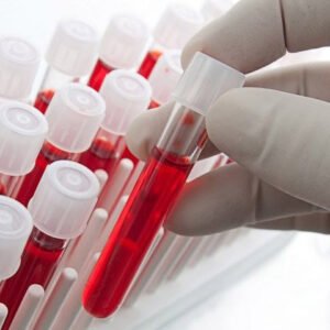 AUDITORIA EM ENFERMAGEM